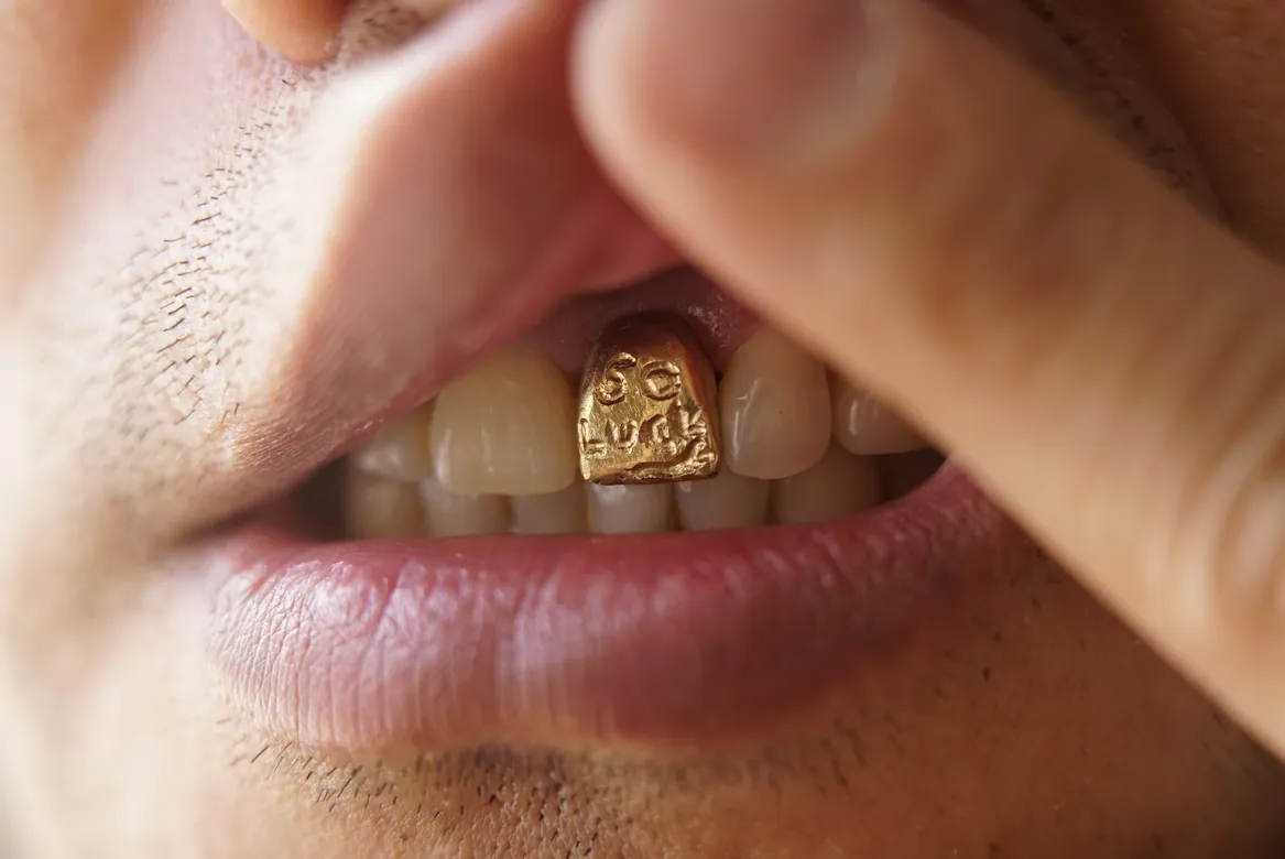 Tooth Gallery